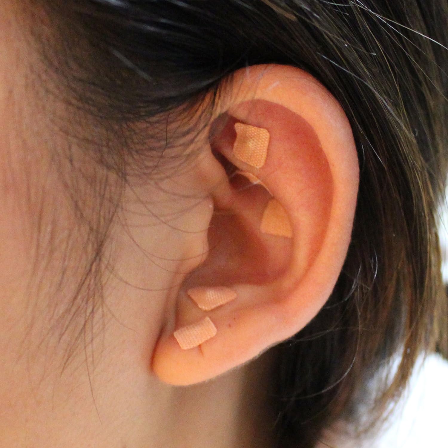 Multi-Conditional Ear Seed Acupuncture Set 600 Sticks | E-Book Placement Chart | Probe | Acupuncture Point Chart | Tweezers
