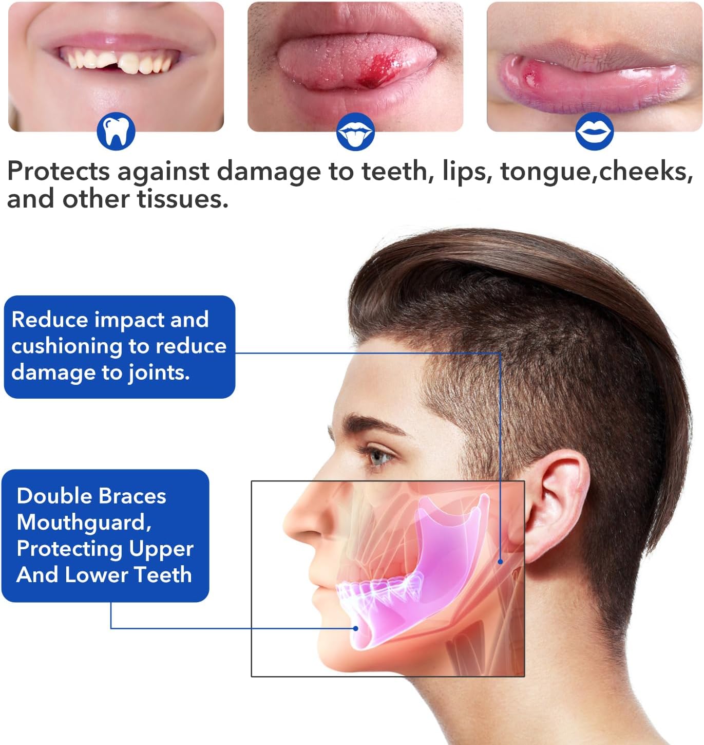 Youth Adult Double Brace Mouth Guard Soft No Boil