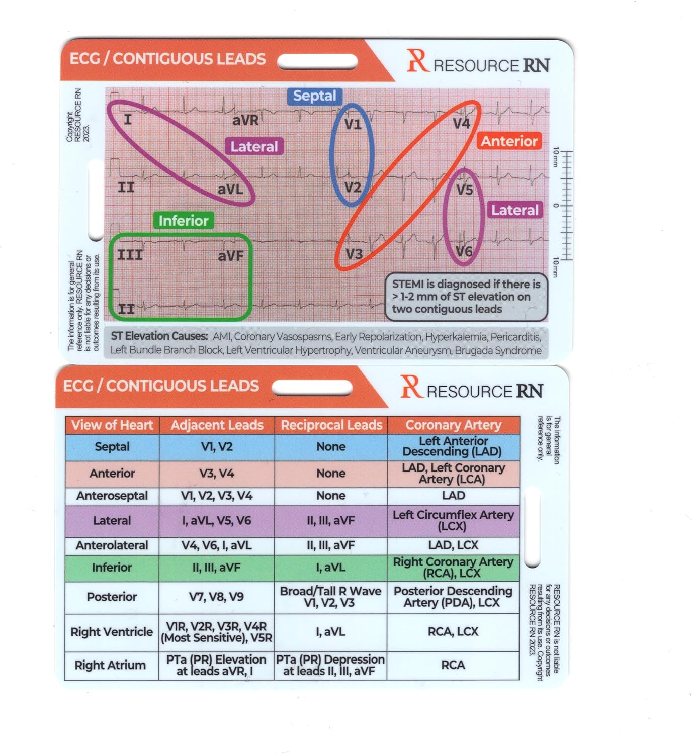 EKG STEMI Analysis Badge Cards for quick interpretation - Compatible with horizontal and vertical layouts